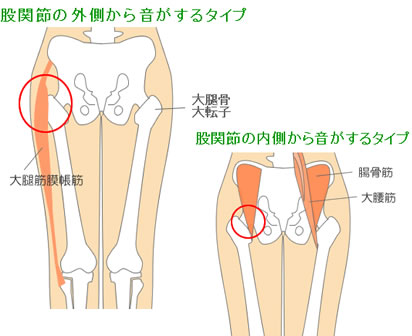 ãå¼¾çºè¡ãã®ç»åæ¤ç´¢çµæ