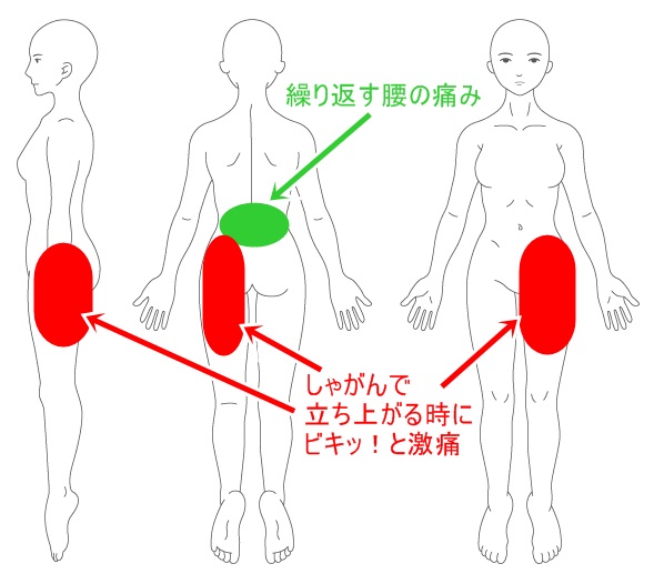 【症状改善例】 歩くと痛い股関節の痛みが整体で改善 東大阪市河内小阪の整体院「からだリカバリーラボ」