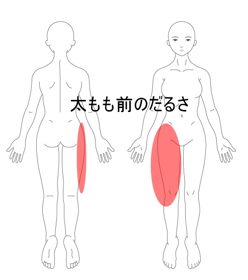 施術改善例 近所の整骨院で１週間マッサージを受けてとれなかった太もものだるさが３回で解消した整体 東大阪市河内小阪の整体院 からだリカバリーラボ