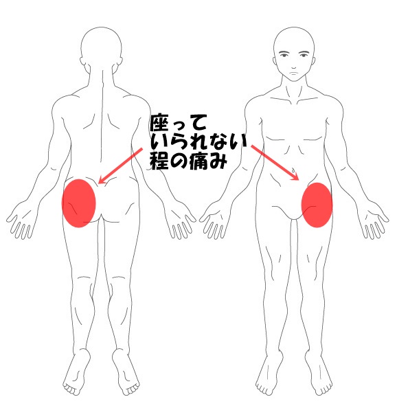 施術改善例 長時間座っていると 痛くて座っていられないお尻の 痛みが改善されました 東大阪市河内小阪の整体院 からだリカバリーラボ