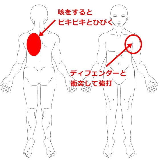 痛い 肩 甲骨 あたり